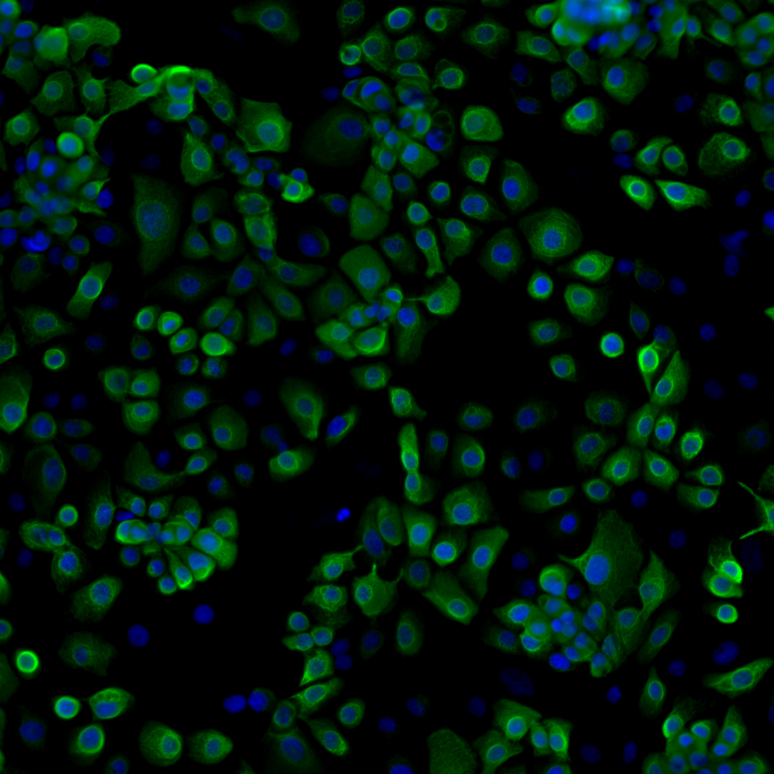 Keratinocytes from Primary Cell and Culture Medium Cell Models